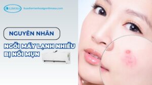 ngồi máy lạnh nhiều bị nổi mụn